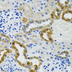 Polymerase DNA Directed Gamma 2 (POLG2) Antibody