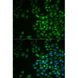 Polymerase DNA Directed Gamma 2 (POLG2) Antibody