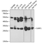 Western blot analysis of extracts of various cell lines using SURF1 Antibody (1/1000 dilution).