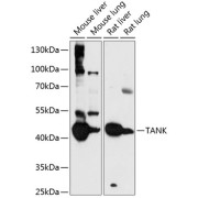 Western blot analysis of extracts of various cell lines using TANK Antibody (1/3000 dilution).