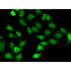 Transcriptional Enhancer Factor TEF-1 (TEAD1) Antibody