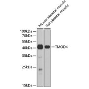 Western blot analysis of extracts of various cell lines using TMOD4 Antibody (1/1000 dilution).