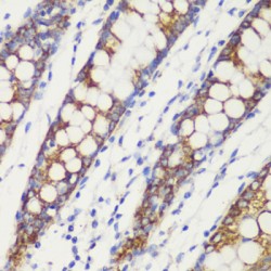 Translocase of Outer Mitochondrial Membrane 20 (TOMM20) Antibody