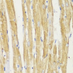 Translocase of Outer Mitochondrial Membrane 20 (TOMM20) Antibody