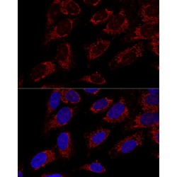 Translocase of Outer Mitochondrial Membrane 20 (TOMM20) Antibody