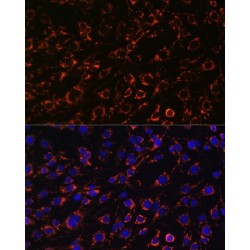 Translocase of Outer Mitochondrial Membrane 20 (TOMM20) Antibody