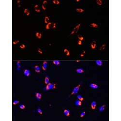 Translocase of Outer Mitochondrial Membrane 20 (TOMM20) Antibody