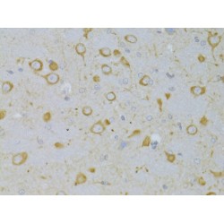 Thyrotropin Receptor (TSHR) Antibody