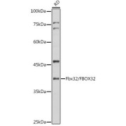 Western blot analysis of extracts of RD cells using Fbx32/FBOX32 Antibody (1/1000 dilution).