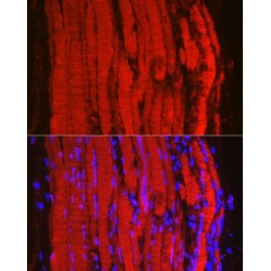 F-Box Protein 32 (FBXO32) Antibody