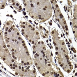 COP9 Signalosome Complex Subunit 1 (GPS1) Antibody