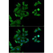 Immunofluorescence analysis of MCF7 cells using HABP2 Antibody