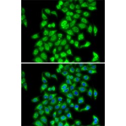 COP9 Signalosome Subunit 3 (COPS3) Antibody