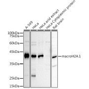 Western blot analysis of extracts of various cell lines using macroH2A.1 Antibody (1/1000 dilution).