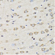 Immunohistochemistry of paraffin-embedded Rat brain using CLIC4 Antibody (1/100 dilution, 40x lens).