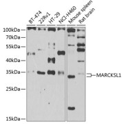 Western blot analysis of extracts of various cell lines using MARCKSL1 Antibody (1/1000 dilution).