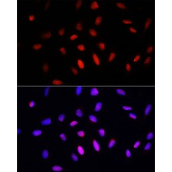 COMM Domain Containing Protein 1 (COMMD1) Antibody