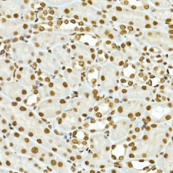 Histone Cluster 2, H4b (HIST2H4B) Antibody