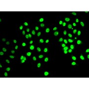 Immunofluorescence analysis of MCF-7 cells using REST Antibody