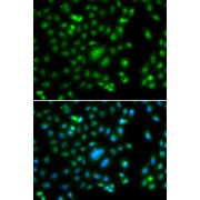 Immunofluorescence analysis of A549 cells using ELF5 Antibody