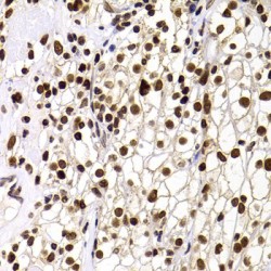 PH-Interacting Protein (PHIP) Antibody