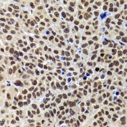 PH-Interacting Protein (PHIP) Antibody