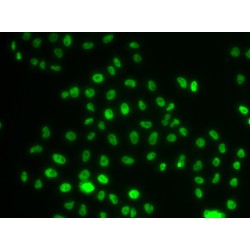 PH-Interacting Protein (PHIP) Antibody