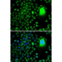 TATA-Box Binding Protein Associated Factor 5 (TAF5) Antibody