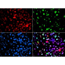 DNA Polymerase Delta 3, Accessory Subunit (POLD3) Antibody