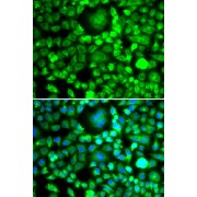 Immunofluorescence analysis of MCF-7 cells using BLID Antibody