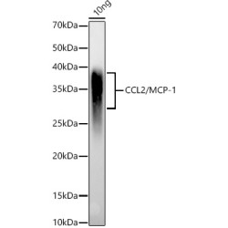 C-C Motif Chemokine 2 / MCP1 (CCL2) Antibody