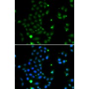 Immunofluorescence analysis of MCF-7 cells using GCM1 Antibody