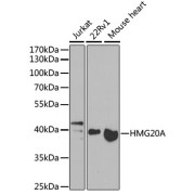 Western blot analysis of extracts of various cell lines using HMG20A Antibody (1/1000 dilution).