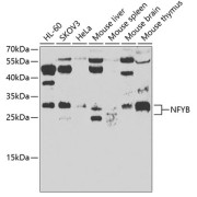 Western blot analysis of extracts of various cell lines using NFYB Antibody (1/500 dilution).