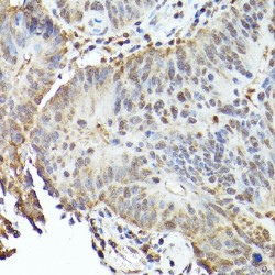 Transcription Factor EB (TFEB) Antibody