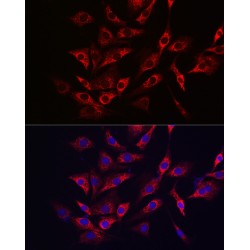 Transcription Factor EB (TFEB) Antibody