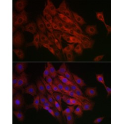 Transcription Factor EB (TFEB) Antibody