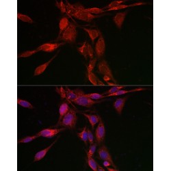 Transcription Factor EB (TFEB) Antibody