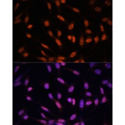 Twist-Related Protein 1 (TWIST1) Antibody