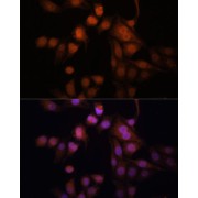 Immunofluorescence analysis of HeLa cells using Twist Antibody (1/100 dilution). Blue: DAPI for nuclear staining.