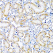 Immunohistochemistry of paraffin-embedded Rat kidney using WRB Antibody (1/200 dilution, 40x lens).