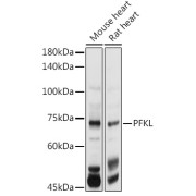 Western blot analysis of extracts of various cell lines using PFKL Antibody (1/1000 dilution).