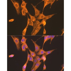 Phosphofructokinase, Liver (PFKL) Antibody