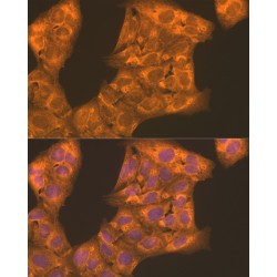 Phosphofructokinase, Liver (PFKL) Antibody