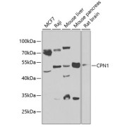 Western blot analysis of extracts of various cell lines using CPN1 Antibody (1/1000 dilution).