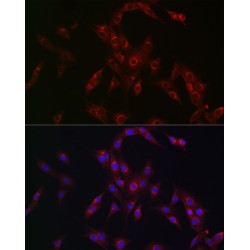 Major Histocompatibility Complex Class I-Related Gene Protein (MR1) Antibody