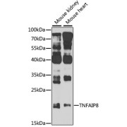 Western blot analysis of extracts of various cell lines using TNFAIP8 Antibody (1/1000 dilution).