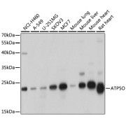 Western blot analysis of extracts of various cell lines using ATP5O Antibody (1/1000 dilution).