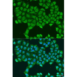 ATP Synthase Subunit O, Mitochondrial (ATP5O) Antibody