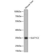 Western blot analysis of extracts of Mouse liver using SULT1C2 Antibody (1/1000 dilution).